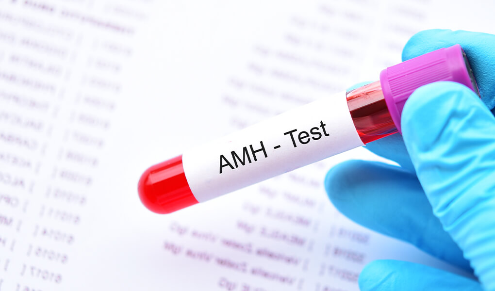 Ce este testul AMH? Valoarea normala a AMH-ului cat este?